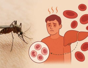 Что нужно знать о малярии