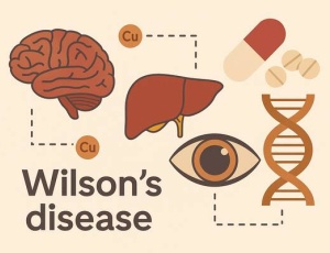 Хвороба Вілсона: порушення обміну міді