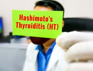 Аутоімунний тиреоїдит