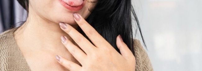 Прикус языка или внутренней губы: что делать