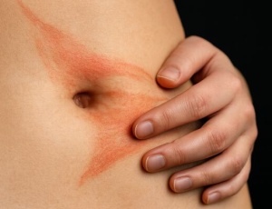 5 причин появления крови из пупка