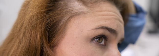 Порідіння волосся: причини, лікування та методи відновлення