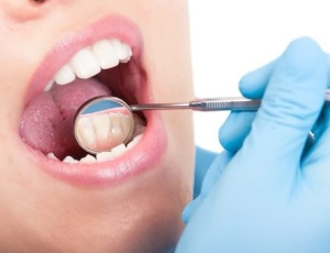 Зубной налет и как защитить зубы