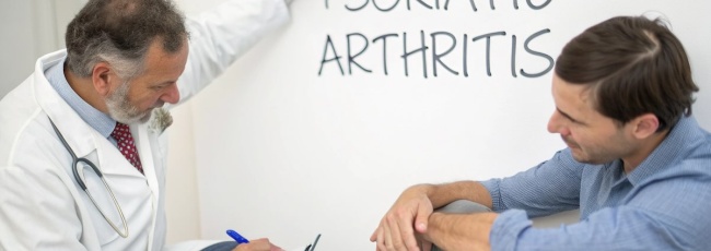 Псоріатичний артрит: причини, симптоми, лікування