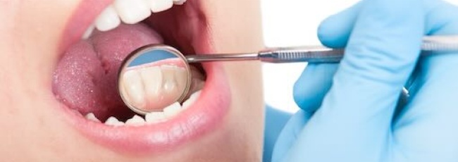 Зубний наліт і як захистити зуби