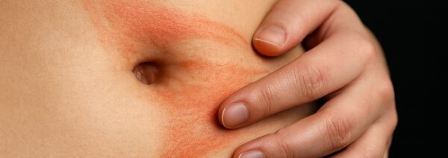 5 причин появления крови из пупка