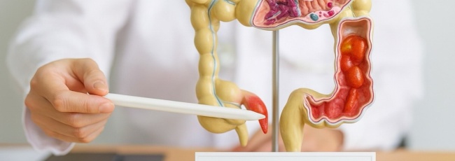 Апендицит: усе, що потрібно знати