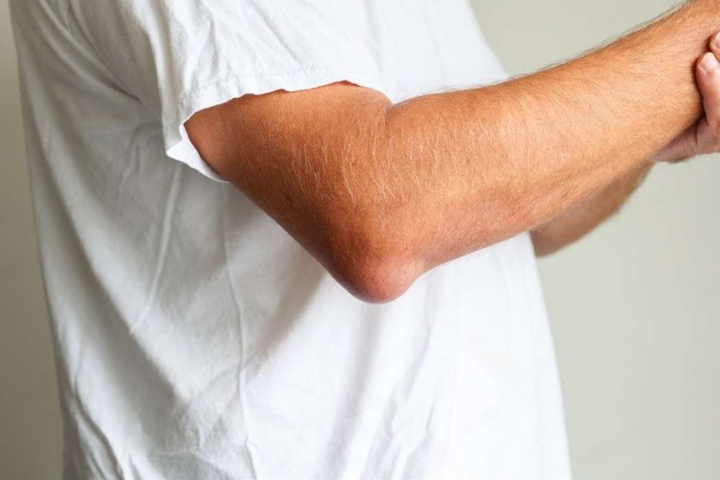 Бурсит локтя: причины, симптомы, лечение