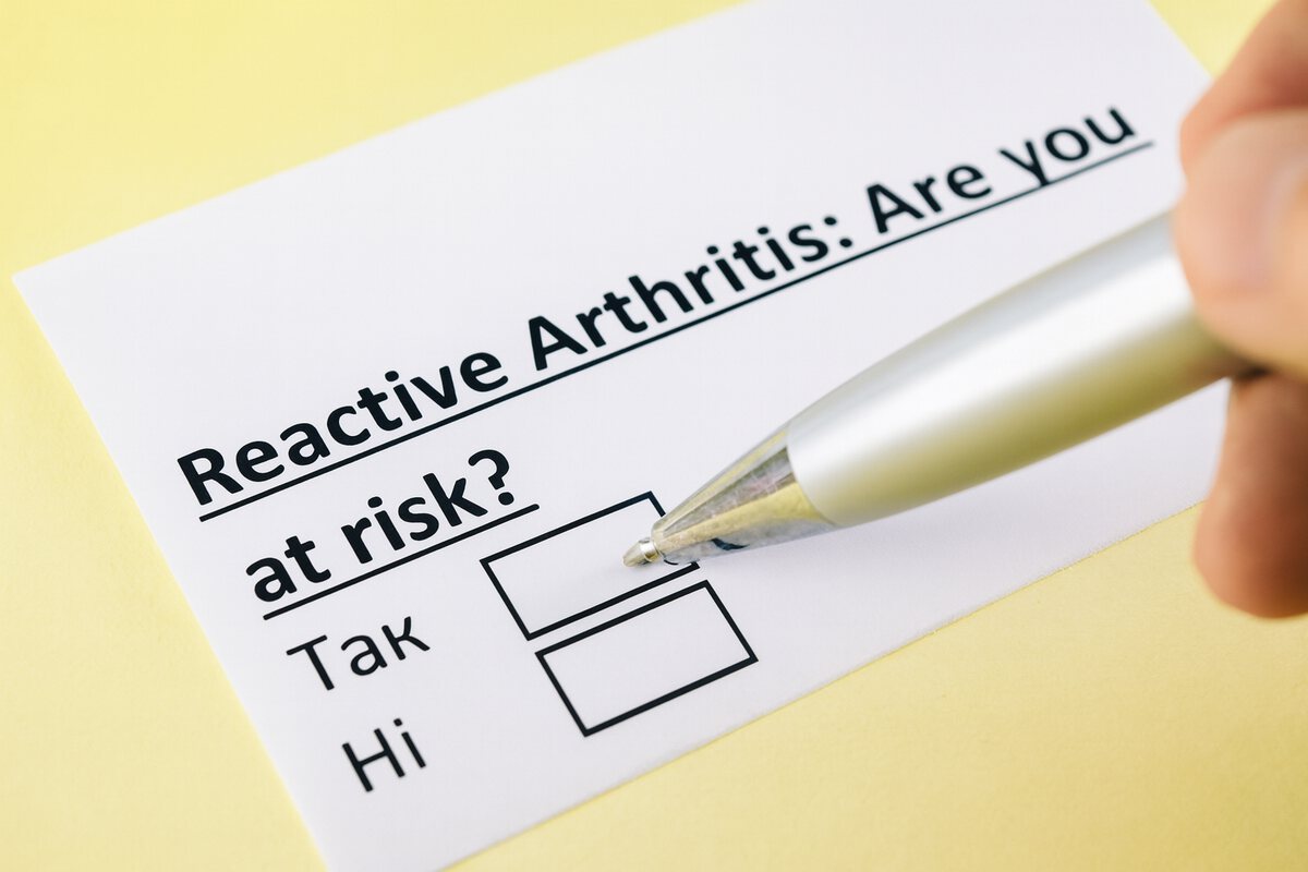 Реактивний артрит: причини, симптоми та лікування