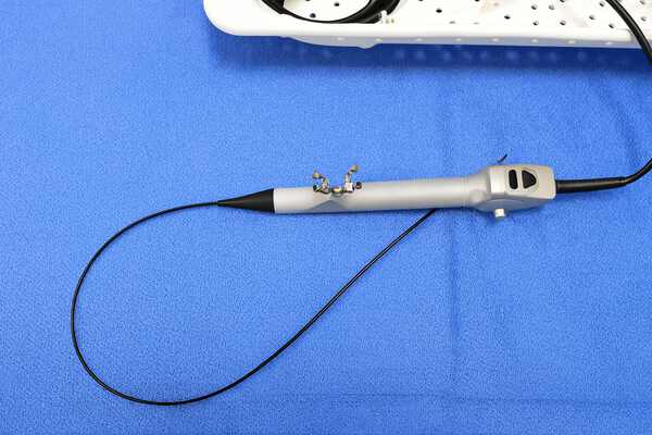 Коли потрібна уретероскопія і як проходить процедура