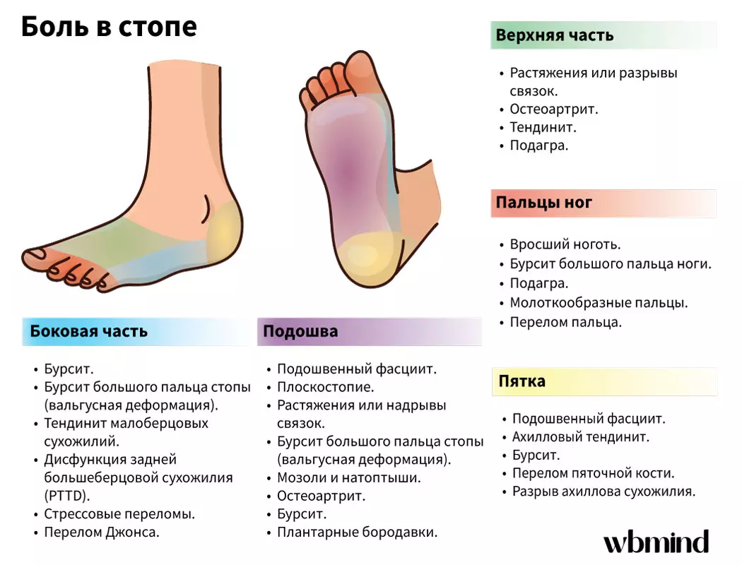 Біль в стопах: причини